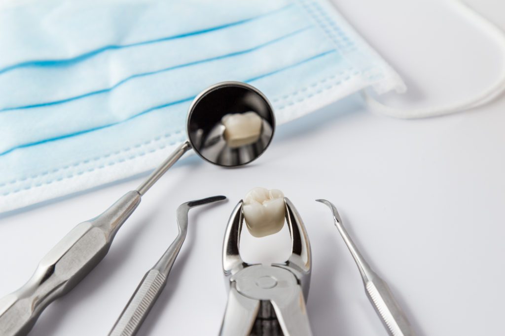 Tooth Extraction in Hendersonville, North Carolina
